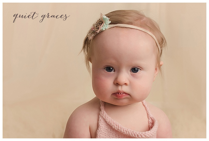 down syndrome baby girl newborn